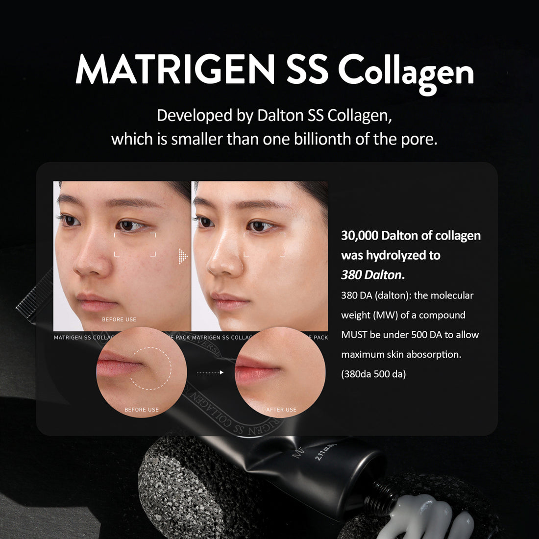 Matrigen